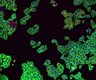 Thumbnail for 110000251829.wpi [Well O15, Field 1]