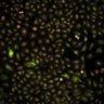 Thumbnail for SQ00014610 [Well 331, Field 2]