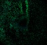 Thumbnail for R3-100mM2DG_400ug_Chol_JRFL