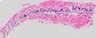Thumbnail for m4 pelvic (20x #2).ome.tiff