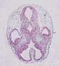 Thumbnail for 12204,1,Head,CS23,74_CHRNB2.ome.tiff