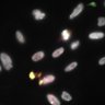 Thumbnail for Dataset1.companion.ome [006]