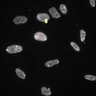 Thumbnail for Dataset1.companion.ome [011]