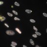 Thumbnail for Dataset1.companion.ome [018]