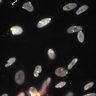 Thumbnail for Dataset1.companion.ome [020]