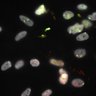 Thumbnail for Dataset1.companion.ome [021]