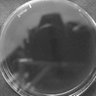 Thumbnail for CI1564_TL_Patient