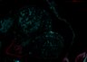 Thumbnail for RBP1 RNAScope CS20_13737_Overview4.PNG