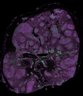Thumbnail for CellDIVE_IBEX_Immune_FL8.ims