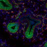 Thumbnail for 20210810 slides ITGA fibro 40um.lif - 14170-ITGA fibro 1-1.tif