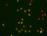 Thumbnail for plate1_1_013 [Well 5, Field 1 (Spot 5)]