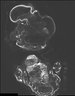 Thumbnail for ExpD_chicken_embryo_stitched.ome.tif