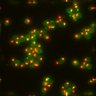 Thumbnail for 1B_MAX_010618_Hsp104Htb1_Meiosis_01_47_zproj_R3D_D3D.tif